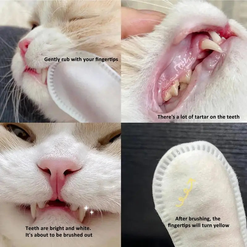 Teeth Wipes 50pcs